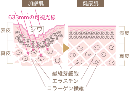 コラーゲンマシン i5