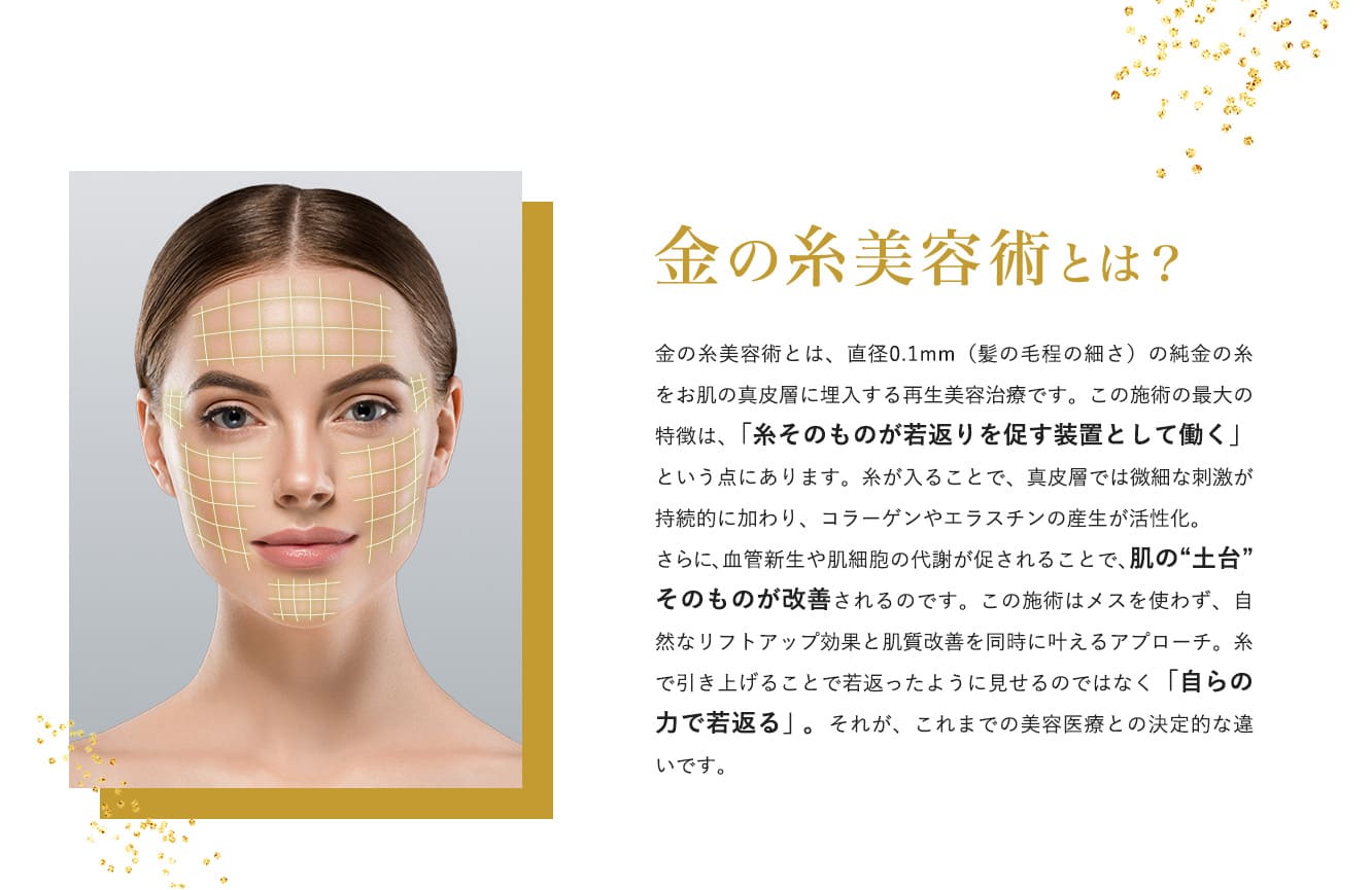 金の糸美容術とは？